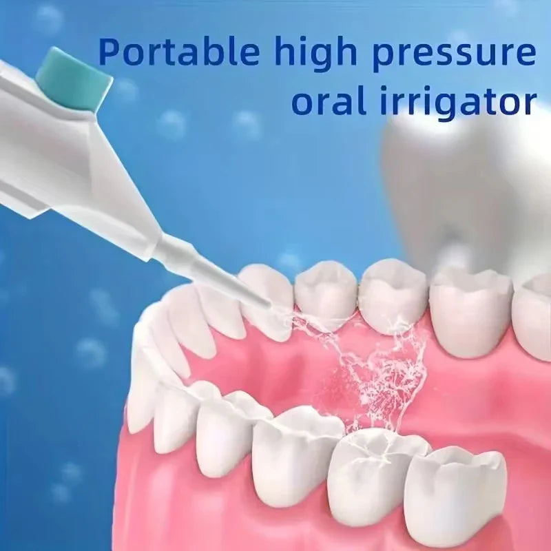 Portable High Pressure Oral Irrigator — Manual Water Dental Flosser for Teeth Cleaning